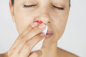 Woman using a sterile gauze bandage to stop a nosebleed.