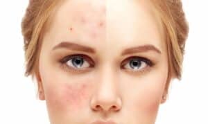 iStock 628469830