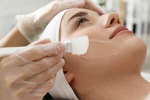 Young,Woman,During,Face,Peeling,Procedure,In,Salon,,Closeup