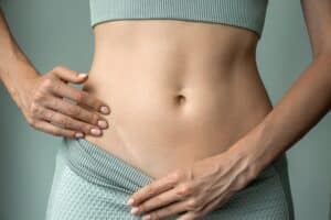 A woman pulling down her waistband to show a scar on her abdomen