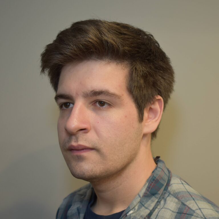 After Image: Submental & Jawline Liposuction and J-Plasma - left-front-oblique