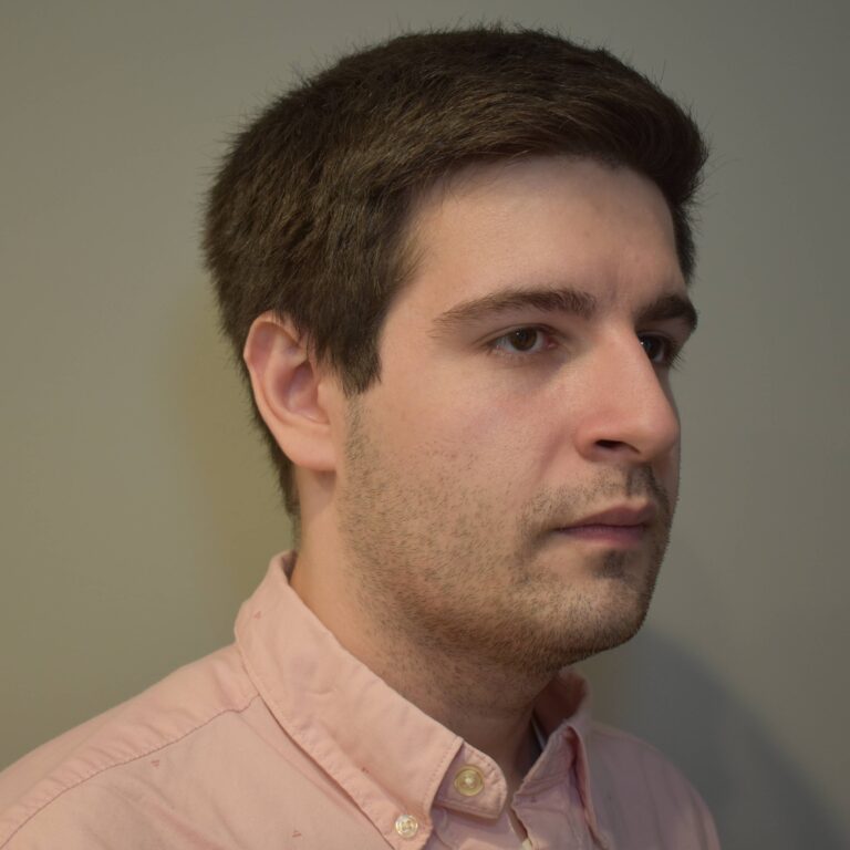 Before Image: Submental & Jawline Liposuction and J-Plasma - right-front-oblique