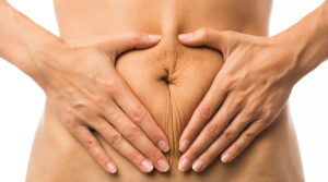 Woman holding loose abdominal skin around her midsection after pregnancy.